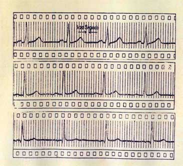 Electrocardiogramas Electrocardiogramas