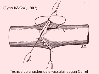 Anastomosis vascular