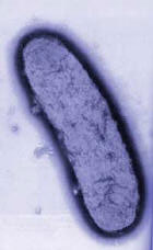 Yersinia pestis